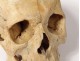 Human skull ancient medicine skinned anatomy Vanity articulated jaw 19th