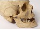 Human skull ancient medicine skinned anatomy Vanity articulated jaw 19th