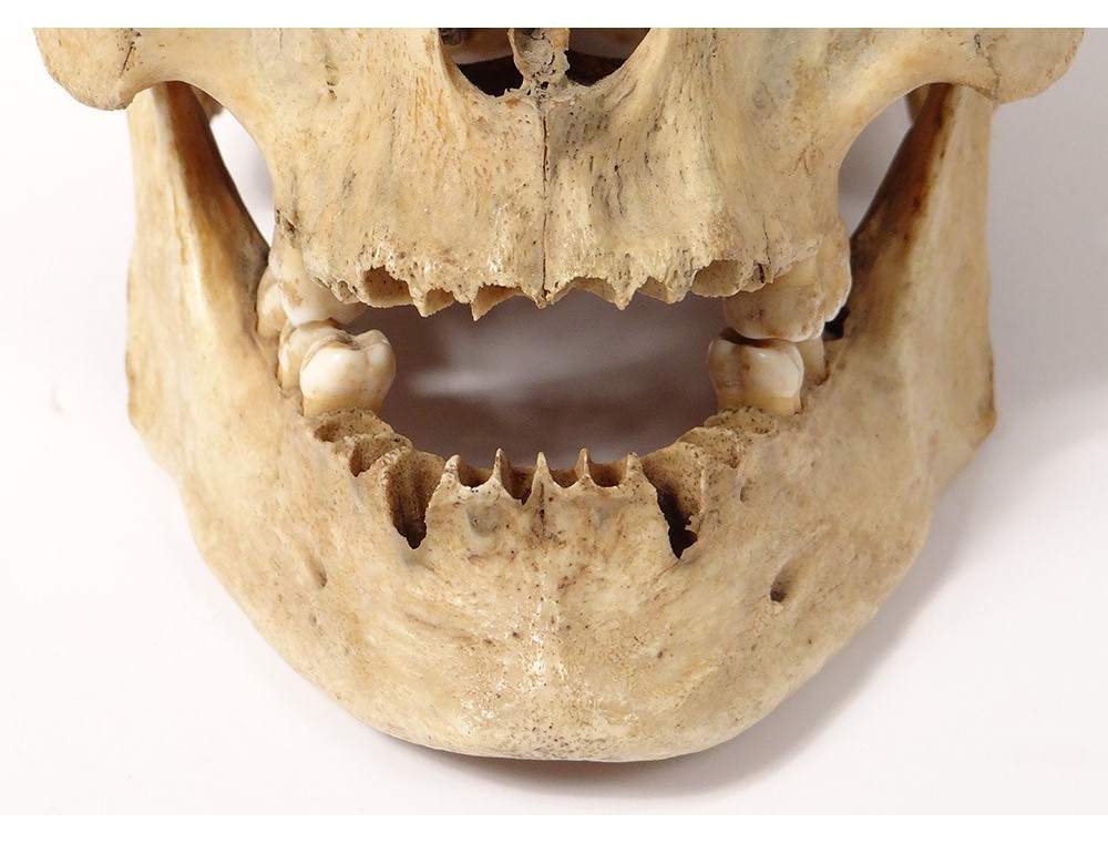 Crâne humain ancien médecine écorché anatomie Vanité machoire articulée 19è