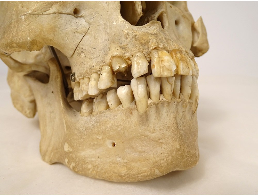 Un Crâne Humain, Une Vue De Trois Quarts Image stock - Image du anatomie,  mâchoire: 125206325