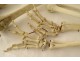 Skeleton human skull medicine flayed anatomy Vanity hands feet twentieth